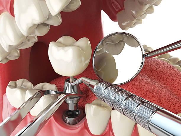 Best Mobile Emergency Dentist in Pigeon, MI